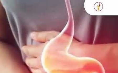 7 Tanda Asam Lambung Kumat, Ada yang Jarang Disadari